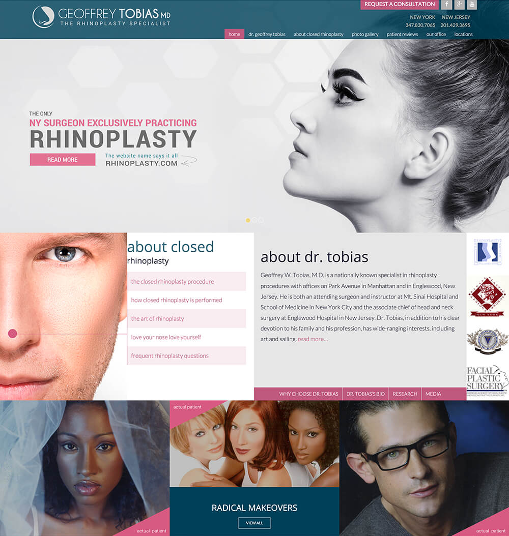 rhinoplasty-ss